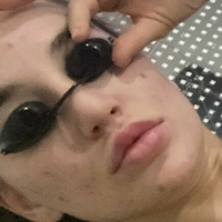 blakeblossomfree Nackt