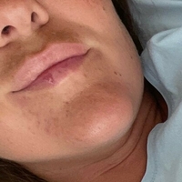 naughty_katarina_free Nackt